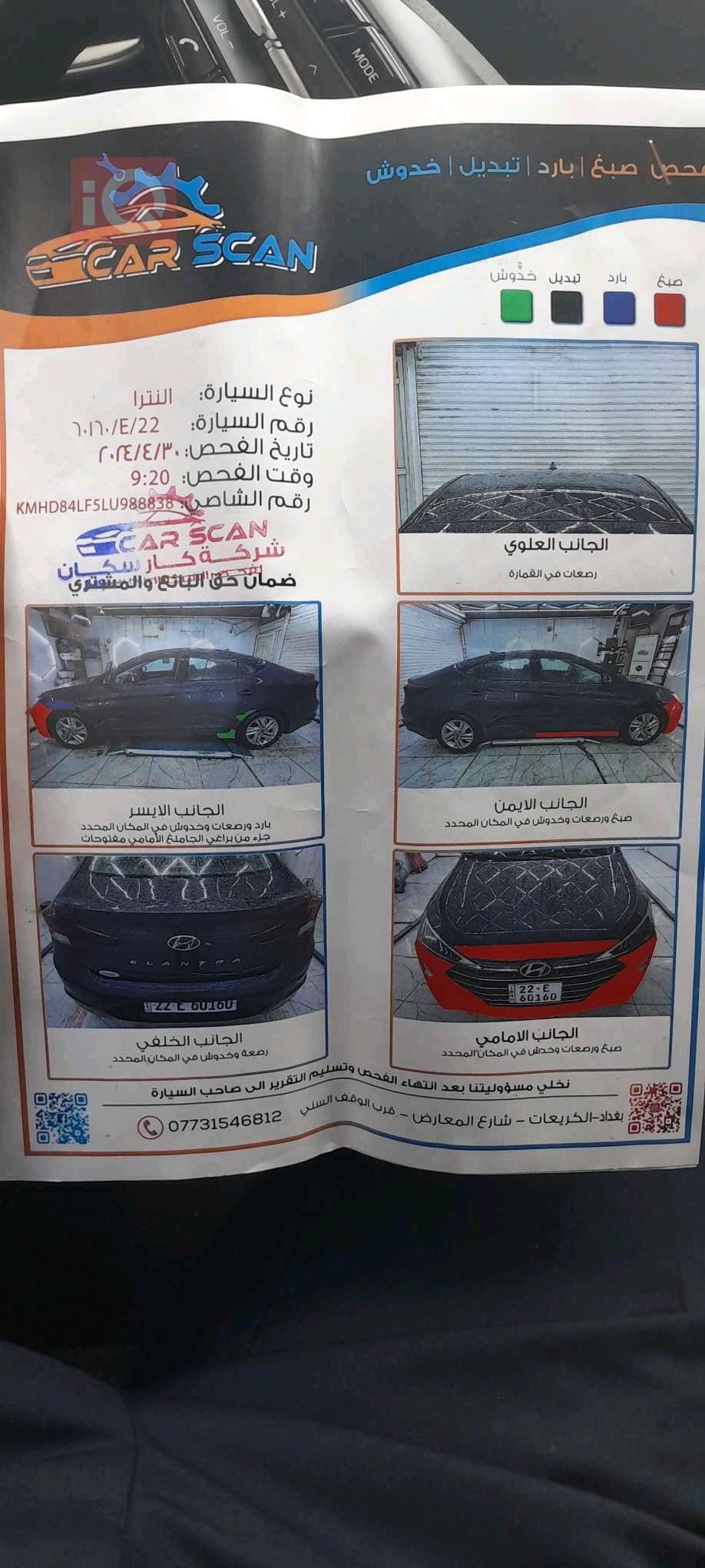 هيونداي النترا